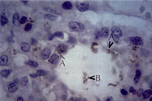 Figure 3. Histological section of lung of a pig experimentally infected with Actinobacillus pleuropneumoniae