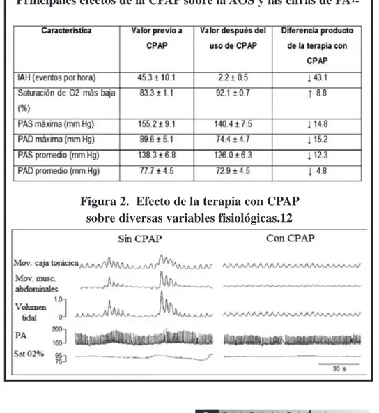 Figura 2.  Efecto de la terapia con CPAP sobre diversas variables fisiológicas.12