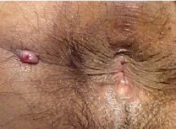 CUADRO CLÍNICO