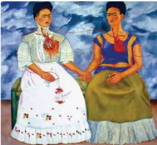 Figura 10  Las dos Fridas como ejemplo de circulación  extracórporea cruzada. Frida Kahlo, 1939