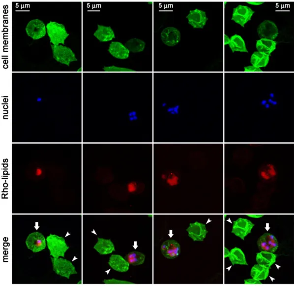 Figure 2. Fluorescence confocal microscopy analysis of the fate of Rho-labeled lipids incorporated in the formulation of pRBC-targeted immunoliposomes added to living P