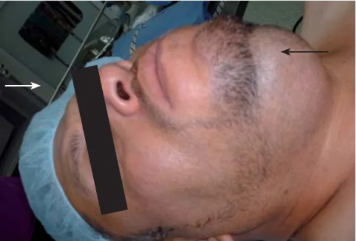 Figura 4. Exploración de la cavidad oral del paciente, la aper-