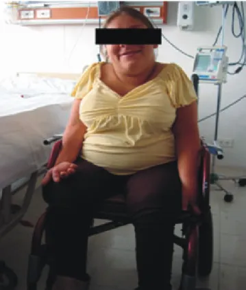 Figura 1. Paciente con diagnóstico de mielitis transversa con 
