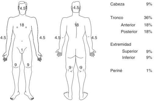 Figura 2. «Regla de los 9».