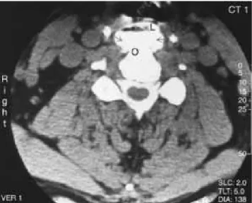 Figure 2. Sagittal view