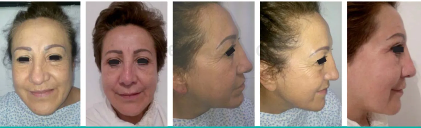 Figure 1. Patient Data: Age: 52 Gender: Female.