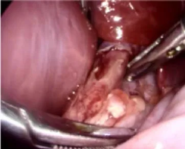 Figura 1.  Esofagograma preoperatorio.