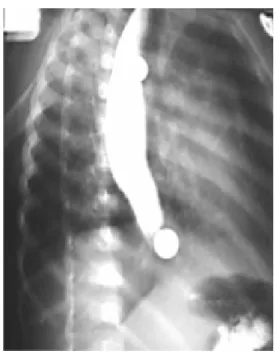 Figura 7.  Esofagograma postoperatorio.