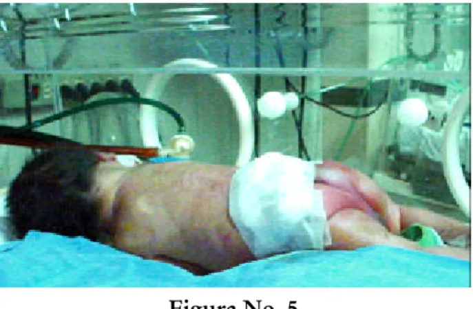 Figura No. 5
