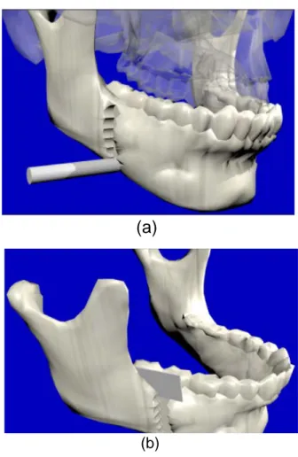 Figure 9: Available cutting process: a) drill b) sagittal saw Fig. 8. Initial positioning of the tool.