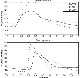 Figura 3 : Formas de onda de presión en las arterias braquial y tibia anterior, para tres niveles de distensibilidad (D) alterada en todos los segmentos excepto en los segmentos braquiales y tibias.