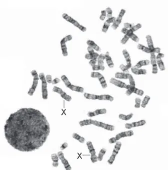 Figura 3. Cromosomas en metafase obtenidos de cultivo de 