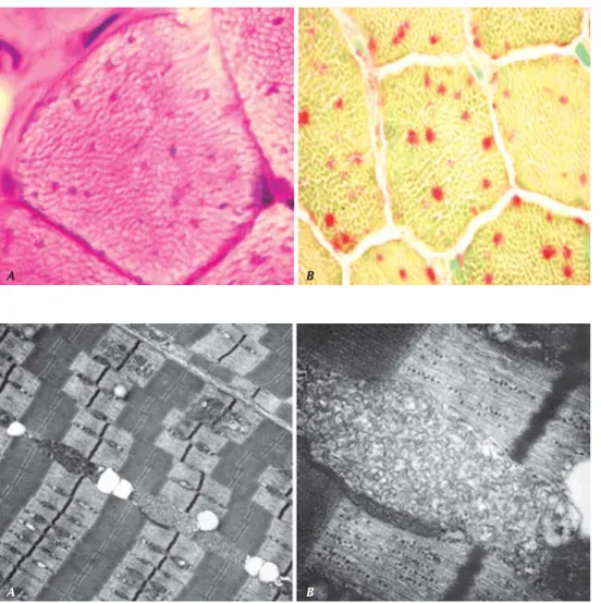 Figura 5. Microscopía electrónica de biop-