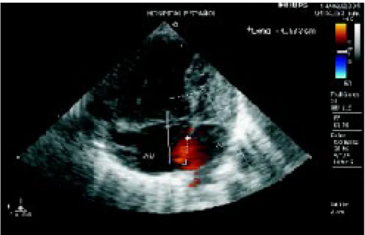 Figura 1. Ultrasonografía cardiaca.