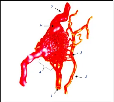 Figura 1. Esquema de una MAV.  . 1 1. Arteria aferente terminal. 2. Arteria aferente de tránsito con participación