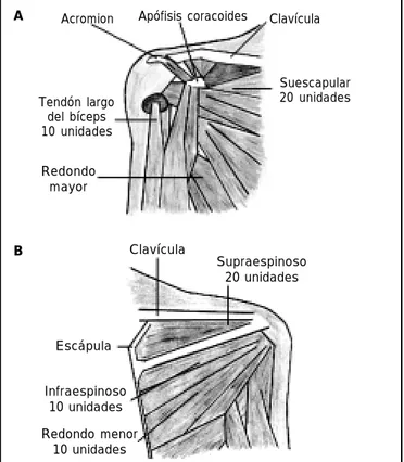 Figura 1. Ultrasonido que muestra el tendón del músculo supraespinoso en vista transversal