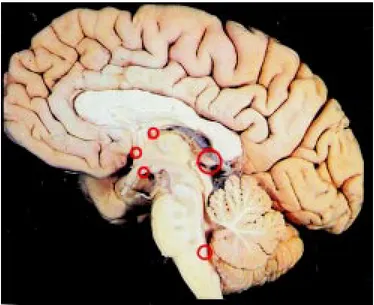 Figura 4. Localización de las estructuras encefálicas que no po- po-seen BHE en el cerebro humano