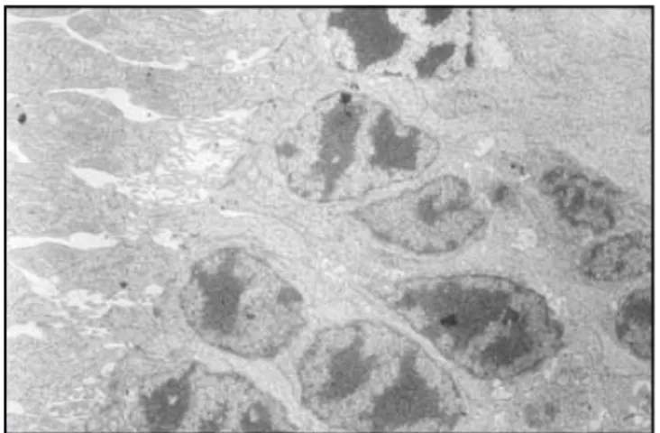 Fig. 4. Fotografía de microscopia electrónica que demuestra la inte- inte-gridad de los fotorreceptores.