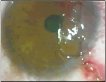 Fig. 3. Fig. 5.