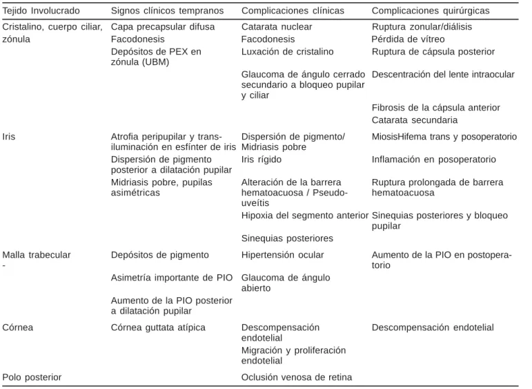 Cuadro 1. Síndrome de pseudoexfoliación (PEX).