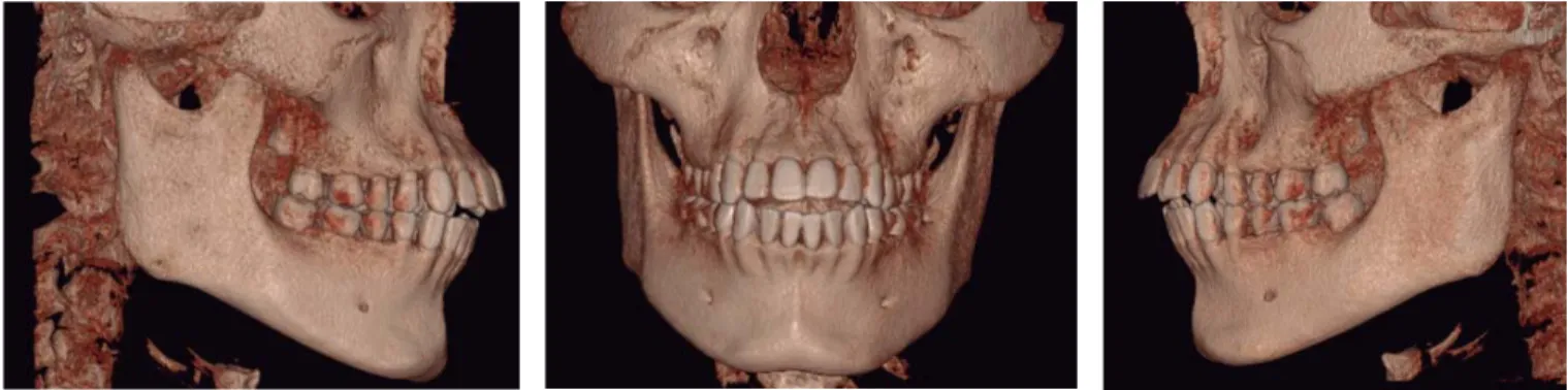 Figure 5. Initial CBCT images.