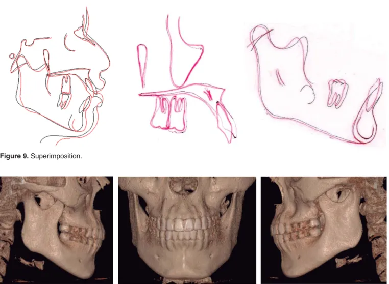 Figure 9. Superimposition.