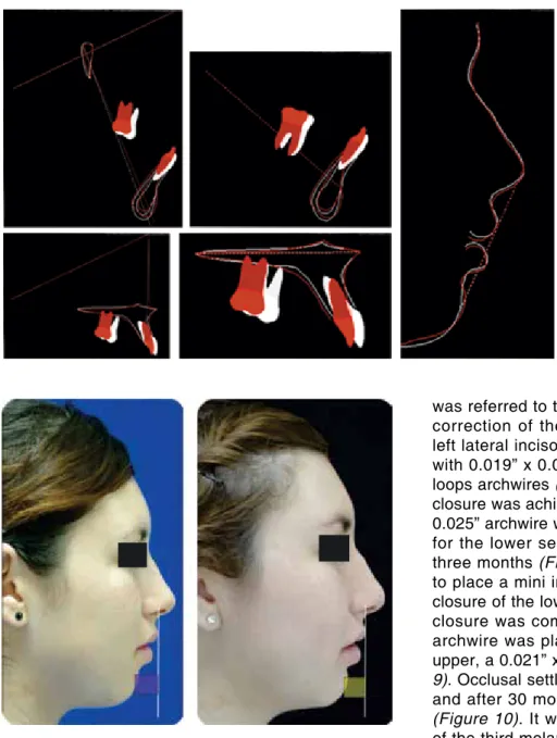 Figure 13. Chin projection.
