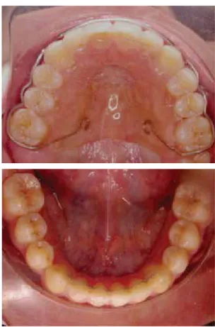 Figure 15. Retention.