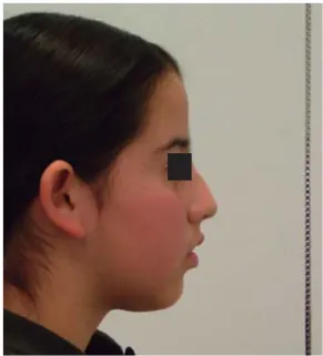Figura 3. Lateral head fi lm in natural posture.