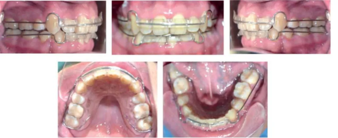 Figure 10. Retention.