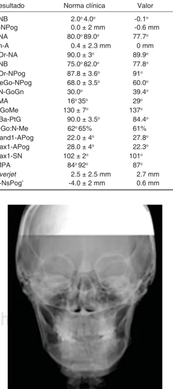 Figura 4. Radiografía lateral del cráneo inicial.