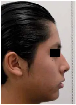 Figure 1. Initial frontal photograph.