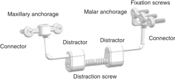 Table I. FEA results for displacement.