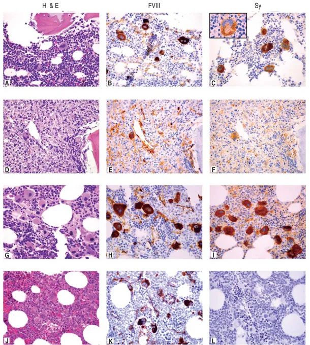 Figure 1. Representative photomicrographs of the four categories of diagnoses. Rows represent an example of each diagnosis (Control, Leuke-