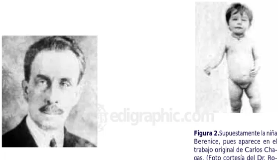 Figura 1. Carlos Chagas.