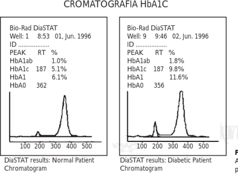 Figura 3. Cromatografía de la hemoglobina A conforme al método cromatográfico de baja presión (LPLC).CROMATOGRAFÍA HbA1CBio-Rad DiaSTATWell: 1     8:53   01, Jun