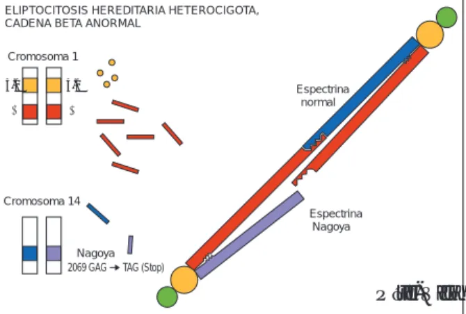 Figura 12. En la beta espectrina eliptogénica Nagoya, un codón