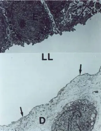Figura 2. Estudio de microscopia electrónica de piel con epider-