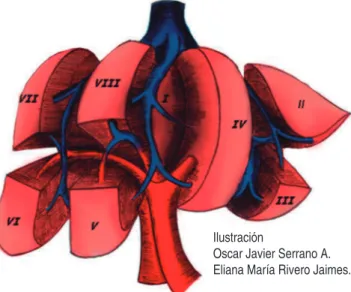 Figura 3. Tipos de resección hepática según los segmentos comprometidos.Seccionectomía (posteriorderecha, anterior derecha,sección medial izquierda y 