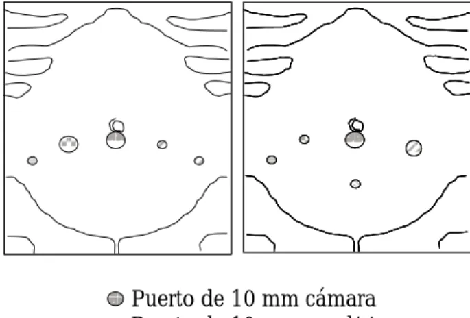 Figura 1. La posición lineal y triangular de colo-