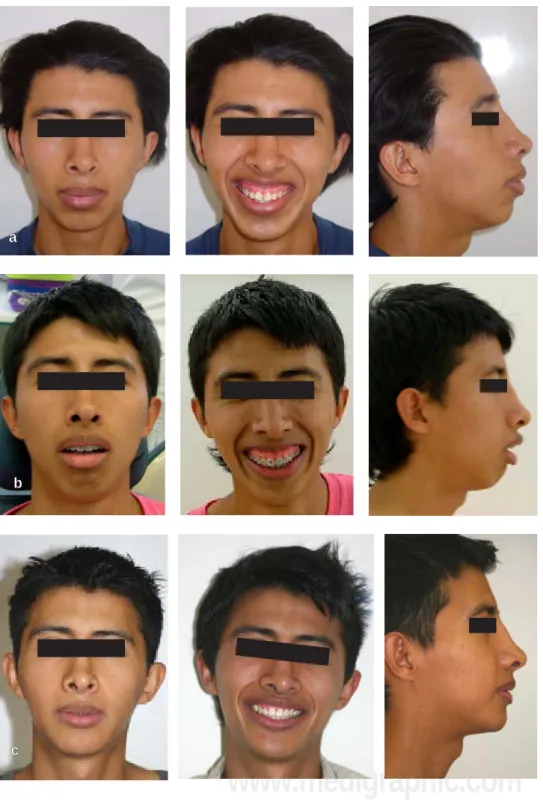 Figura 7. Relación comparativa