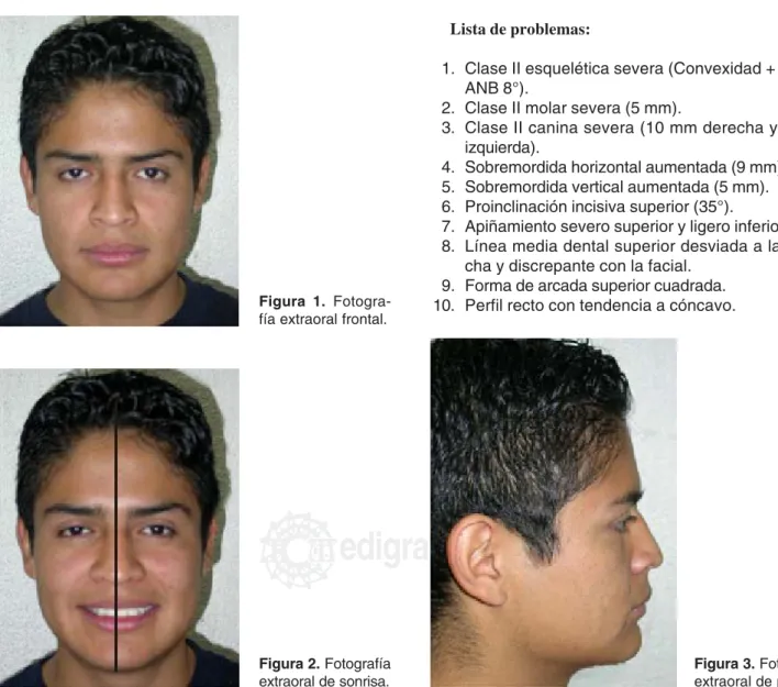 Figura 1. Fotogra-