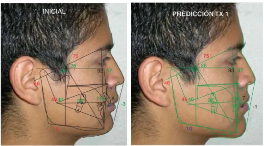 Figura 12. Predicción del trata-