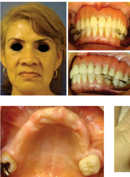 Figure 2. Maxilla alveolar process.