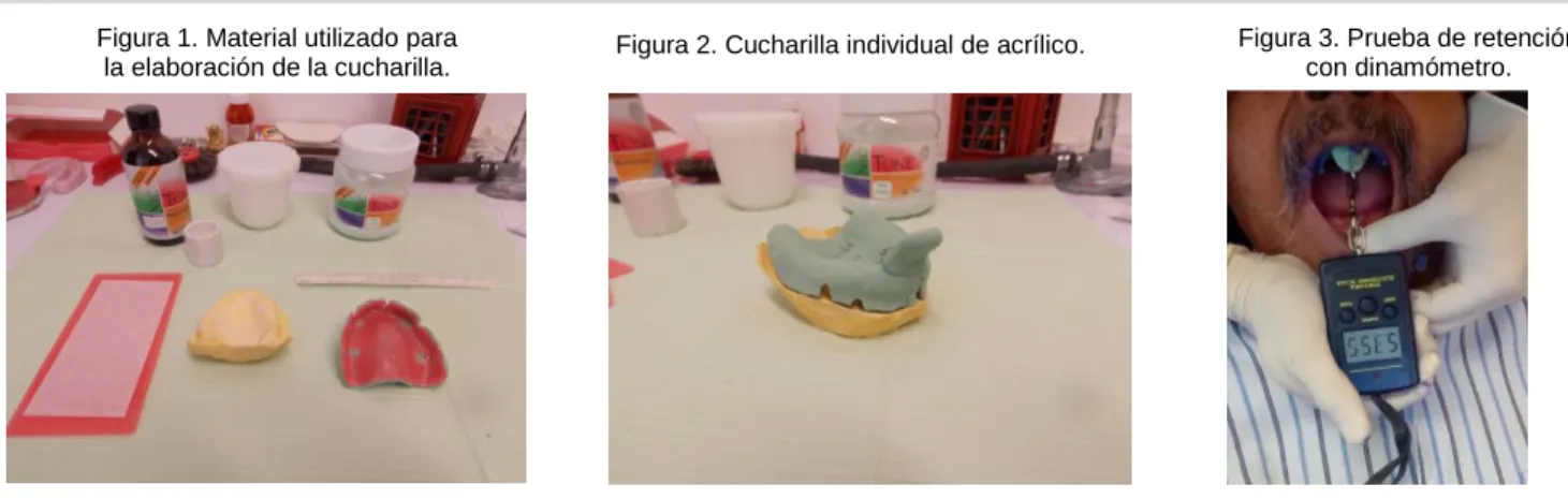 Figura 1. Material utilizado para                                