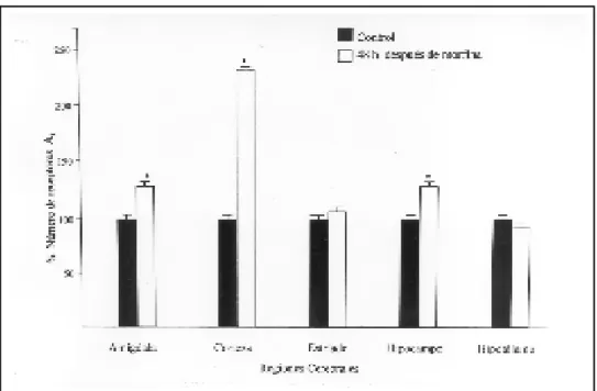 Figura 3. Representación por-