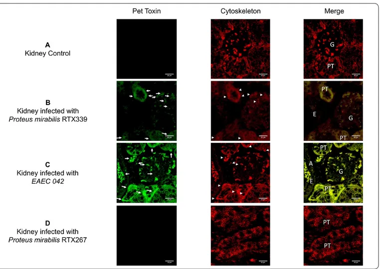 Figure 6. Detection of Pet in kidney tissue of mice infected with different bacterial strains