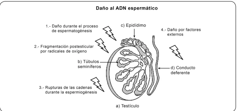 Figura 2. Daño al ADN espermático. El daño al ADN en los espermatozoides puede ocurrir durante la producción o el transporte  de las células espermáticas e incluye: 1) apoptosis durante el proceso de espermatogénesis; 2) fragmentación postesticular  del AD