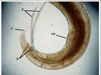 Figure 2:  Masculine caudal structures of A. dissimilis, S: Unequal  spicules without gubernaculum