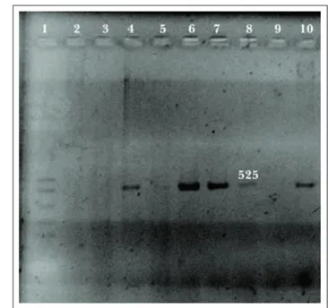 Figura 1. Resultados de la PCR, positivos al fragmento 329 pb de  SE FT 13 A en un gel de agarosa teñido con bromuro de etidio